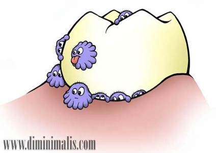 cara membersihkan karang gigi, cara menghilangkan karang gigi dengan garam, cara menghilangkan karang gigi dengan baking soda,